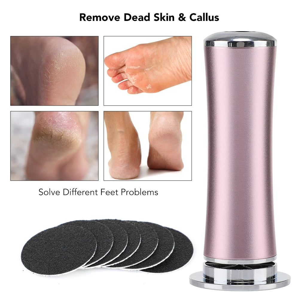 Electric Foot Callus Exterminator